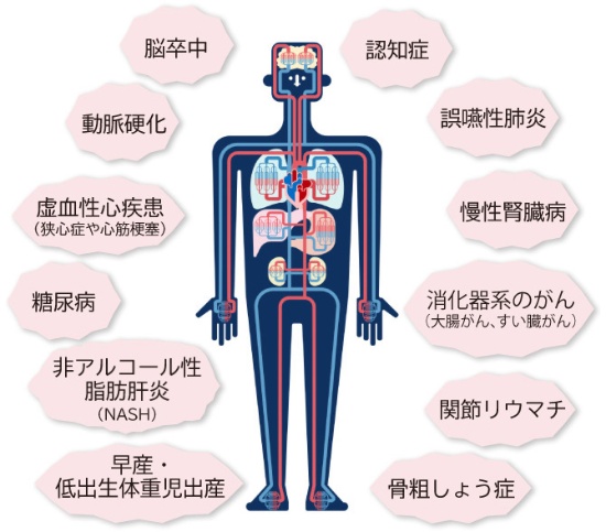 成田（千葉県成田市）の歯医者、メイプル歯科はなのき台クリニックの歯周病治療