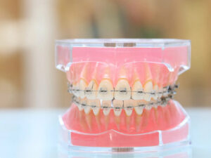 成田（千葉県成田市）の歯医者、メイプル歯科はなのき台クリニックで歯が通常より多い「過剰歯」が引き起こすトラブルと日々のケア方法・治療法を解説