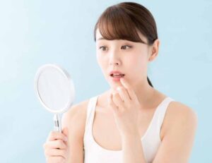 成田（千葉県成田市）の歯医者、メイプル歯科はなのき台クリニックで口内炎についての解説