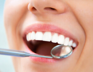 成田（千葉県成田市）の歯医者、メイプル歯科はなのき台クリニックでインプラントのネジが見える！その原因や対処法・予防法を解説