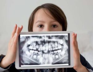 成田（千葉県成田市）の歯医者、メイプル歯科はなのき台クリニックで歯が通常より多い「過剰歯」が引き起こすトラブルと日々のケア方法・治療法を解説