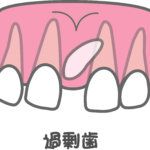 成田（千葉県成田市）の歯医者、メイプル歯科はなのき台クリニックで歯が通常より多い「過剰歯」が引き起こすトラブルと日々のケア方法・治療法を解説