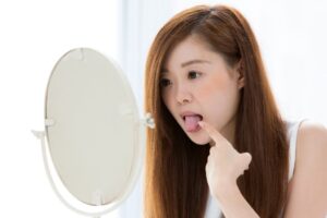 成田（千葉県成田市）の歯医者、メイプル歯科はなのき台クリニックで、舌がピリピリ痛む「舌痛症」とは？更年期やストレスとの関わりを解説